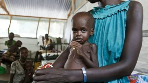 Malnutrition